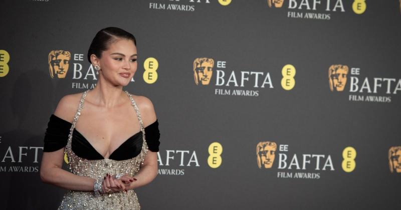 Selena Gomez új szintre emelte a vonzerejét, és minden eddiginél lenyűgözőbben ragyog.
